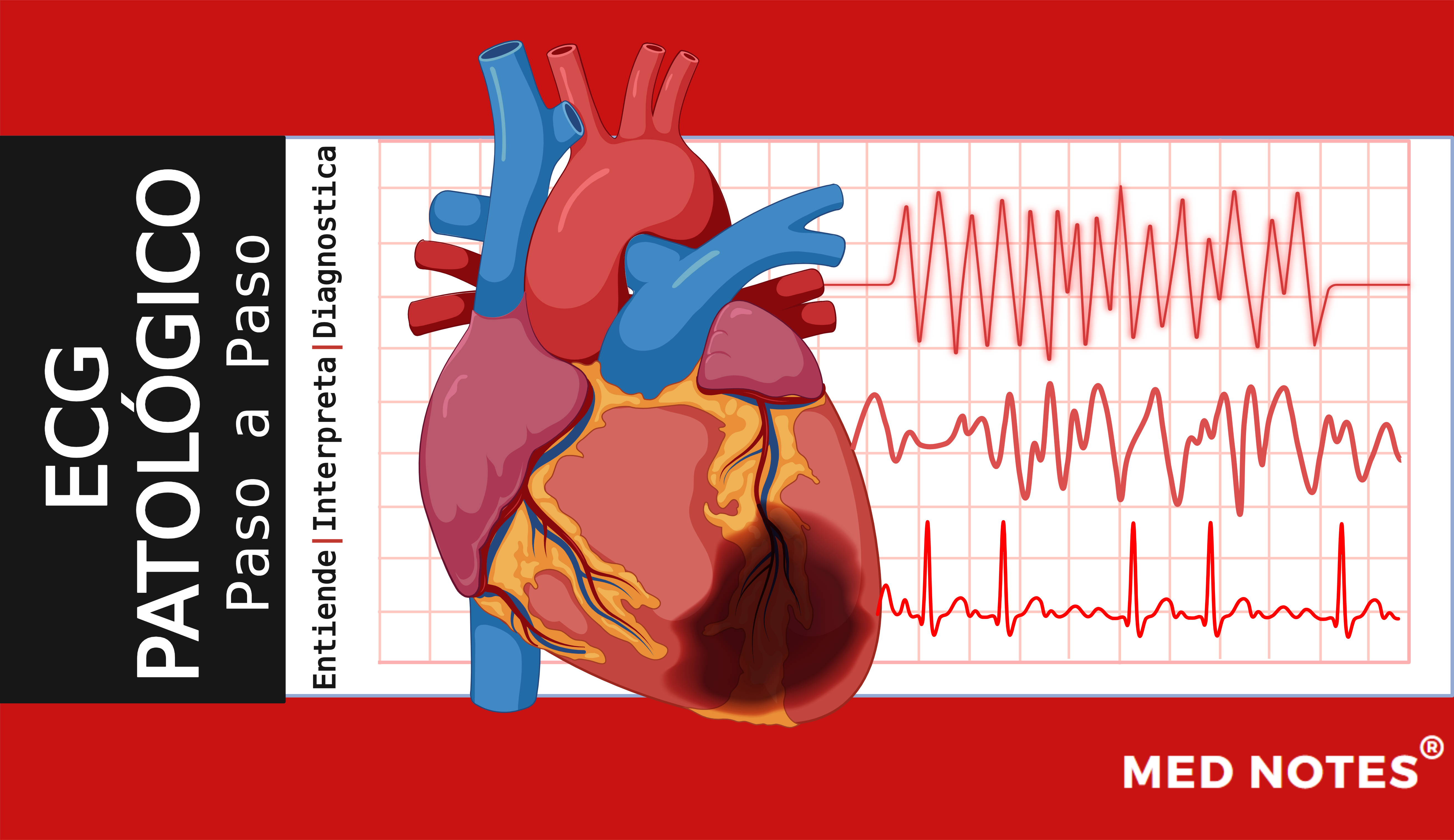 Guía paso a paso: ECG Patológico