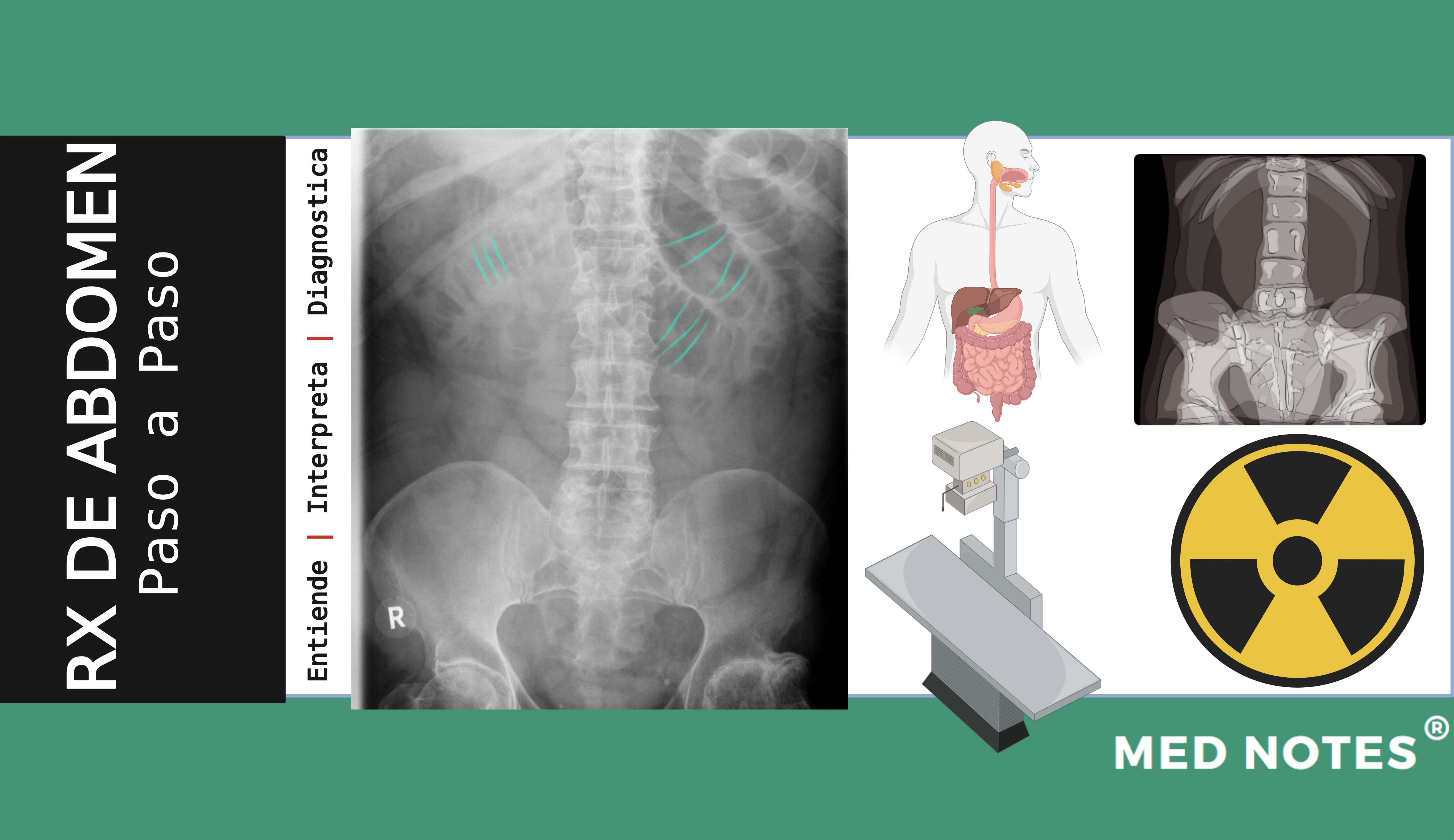 Guía paso a paso: Radiografía de abdomen